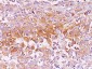  gp100 / Melanosome / PMEL17 / SILV (Melanoma Marker) Antibody - With BSA and Azide