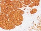  Tyrosinase (Melanoma Marker) Antibody - With BSA and Azide