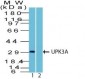  Uroplakin 3A (Bladder Carcinoma Marker) Antibody - With BSA and Azide