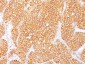  Renal Cell Carcinoma / gp200 Antibody - With BSA and Azide