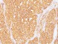  Renal Cell Carcinoma / gp200 Antibody - With BSA and Azide