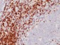  CD5 (Mantle Cell Lymphoma Marker) Antibody - With BSA and Azide