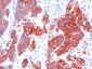  Cytokeratin, Multi (Epithelial Marker) Antibody - With BSA and Azide