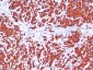  Cytokeratin, pan (Epithelial Marker) Antibody - With BSA and Azide
