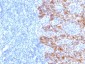  Cytokeratin, Acidic (Type I or LMW) (Epithelial Marker) Antibody - With BSA and Azide