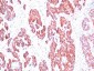  Cytokeratin, Basic (Type II or HMW) (Epithelial Marker) Antibody - With BSA and Azide