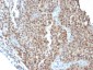  p21WAF1 (Tumor Suppressor Protein) Antibody - With BSA and Azide