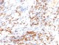  p27Kip1 (Mitotic Inhibitor/Suppressor Protein) Antibody - With BSA and Azide