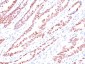  p57Kip2 (Mitotic Inhibitor/Suppressor Protein) Antibody - With BSA and Azide