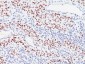  p57Kip2 (Mitotic Inhibitor/Suppressor Protein) Antibody - With BSA and Azide