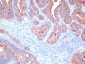  Carcinoembryonic Antigen, pan (CEA) / CD66 Antibody - With BSA and Azide