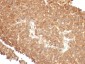  Topoisomerase (DNA) I, Mitochondrial (TOP1MT) Antibody - With BSA and Azide