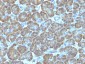  Topoisomerase (DNA) I, Mitochondrial (TOP1MT) Antibody - With BSA and Azide