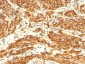 Calponin-1 (Smooth Muscle Marker) Antibody - With BSA and Azide