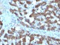  CPS1 / Carbamoyl-Phosphate Synthetase (Hepatocellular Marker) Antibody - With BSA and Azide