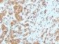  MART-1 / Melan-A / MLANA (Melanoma Marker) Antibody - With BSA and Azide