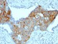  TRIM29 (Lung Squamous Cell Carcinoma Marker) Antibody - With BSA and Azide