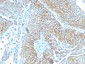  TRIM29 (Lung Squamous Cell Carcinoma Marker) Antibody - With BSA and Azide
