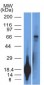  TRIM29 (Lung Squamous Cell Carcinoma Marker) Antibody - With BSA and Azide