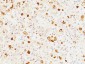  FSH-beta (Follicle Stimulating Hormone-beta) Antibody - With BSA and Azide