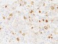  FSH-beta (Follicle Stimulating Hormone-beta) Antibody - With BSA and Azide