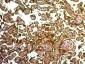  Placental Alkaline Phosphatase (PLAP) (Germ Cell Tumor Marker) Antibody - With BSA and Azide