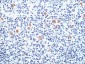  CD15 / FUT4 (Reed-Sternberg Cell Marker) Antibody - With BSA and Azide