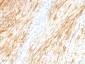  GFAP (Astrocyte & Neural Stem Cell Marker) Antibody - With BSA and Azide