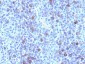  Glypican-3 (GPC3) (Hepatocellular Carcinoma Marker) Antibody - With BSA and Azide