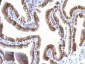  TOX3 / TNRC9 Antibody - With BSA and Azide