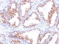  Androgen Receptor (Marker of Androgen Dependence) Antibody - With BSA and Azide