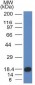  CD117 / c-Kit (Marker for Gastrointestinal Stromal Tumors) Antibody - With BSA and Azide