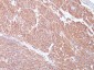  CD117 / c-Kit (Marker for Gastrointestinal Stromal Tumors) Antibody - With BSA and Azide