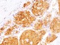  Arginase 1 (Hepatocellular Carcinoma Marker) Antibody - With BSA and Azide