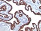  Cytokeratin 7 (KRT7) (Glandular and Transitional Epithelial Marker) Antibody - With BSA and Azide