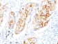  Cytokeratin 7 (KRT7) (Glandular and Transitional Epithelial Marker) Antibody - With BSA and Azide