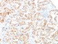  Cytokeratin 7 (KRT7) (Glandular and Transitional Epithelial Marker) Antibody - With BSA and Azide