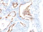  Cytokeratin 7 (KRT7) (Glandular and Transitional Epithelial Marker) Antibody - With BSA and Azide