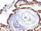  Cytokeratin 7 (KRT7) (Glandular and Transitional Epithelial Marker) Antibody - With BSA and Azide