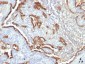  Cytokeratin 7 (KRT7) (Glandular and Transitional Epithelial Marker) Antibody - With BSA and Azide