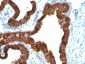  Cytokeratin 7 (KRT7) (Glandular and Transitional Epithelial Marker) Antibody - With BSA and Azide