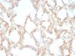  Cytokeratin 7 (KRT7) (Glandular and Transitional Epithelial Marker) Antibody - With BSA and Azide