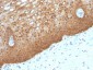  Cytokeratin 14 (KRT14) (Squamous Cell Marker) Antibody - With BSA and Azide