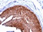  Cytokeratin 17 (KRT17) (Basal Epithelial Marker) Antibody - With BSA and Azide