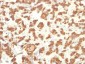  Cytokeratin 18 (KRT18) Antibody - With BSA and Azide