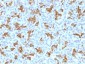  Cytokeratin 19 (KRT19) (Pancreatic Stem Cell Marker) Antibody - With BSA and Azide