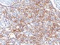  Ep-CAM / CD326 (Epithelial Marker) Antibody - With BSA and Azide