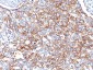  Ep-CAM / CD326 (Epithelial Marker) Antibody - With BSA and Azide