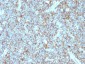  CD99 / MIC2 (Ewing's Sarcoma Marker) Antibody - With BSA and Azide
