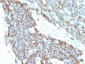  CD99 / MIC2 (Ewing's Sarcoma Marker) Antibody - Culture Supernatant 